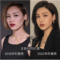 面部抗衰年轻化