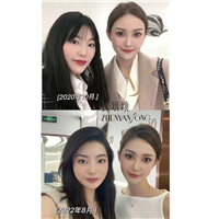 面部微创年轻化