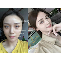 重庆医美怎么样