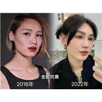重庆做面部抗衰哪家好