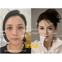 重庆美容