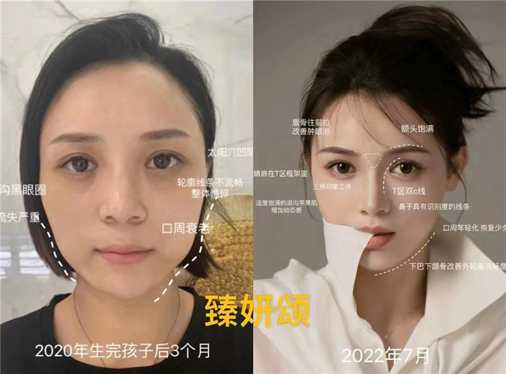 重庆美容