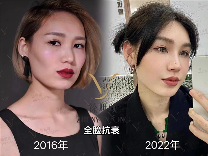 重庆做面部抗衰哪家好