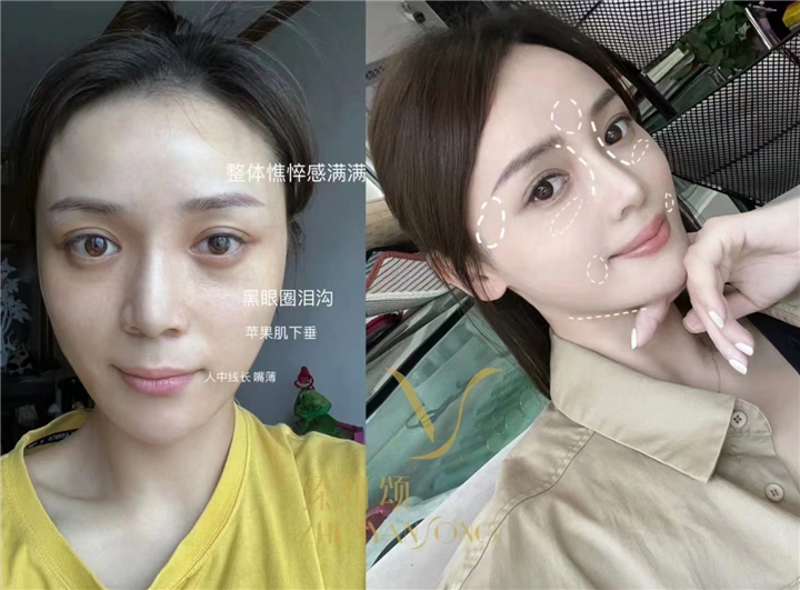 重庆医美怎么样