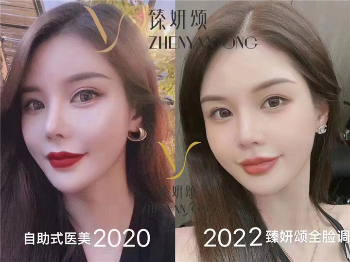 重庆医学面雕