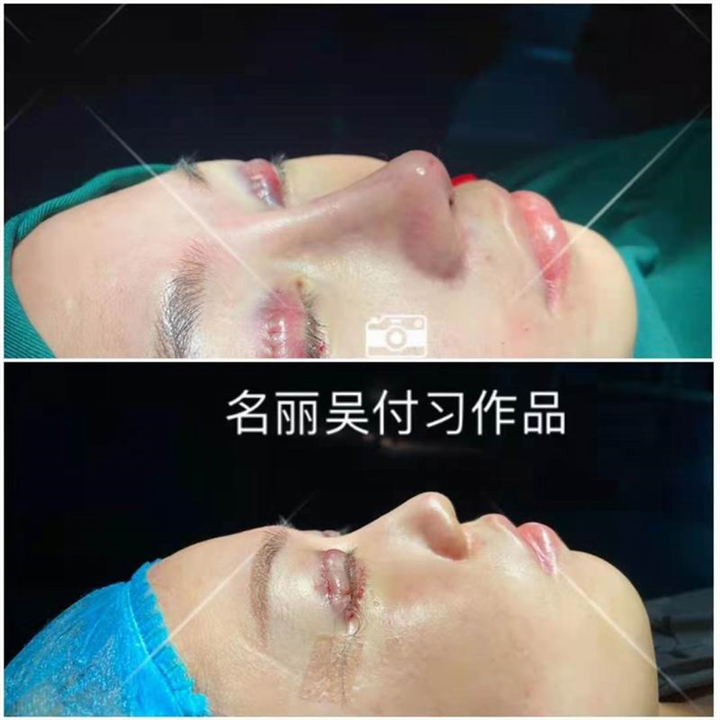 吴付习 