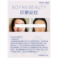 剥离微雕