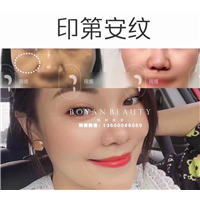 剥离微整