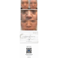 剥离微整