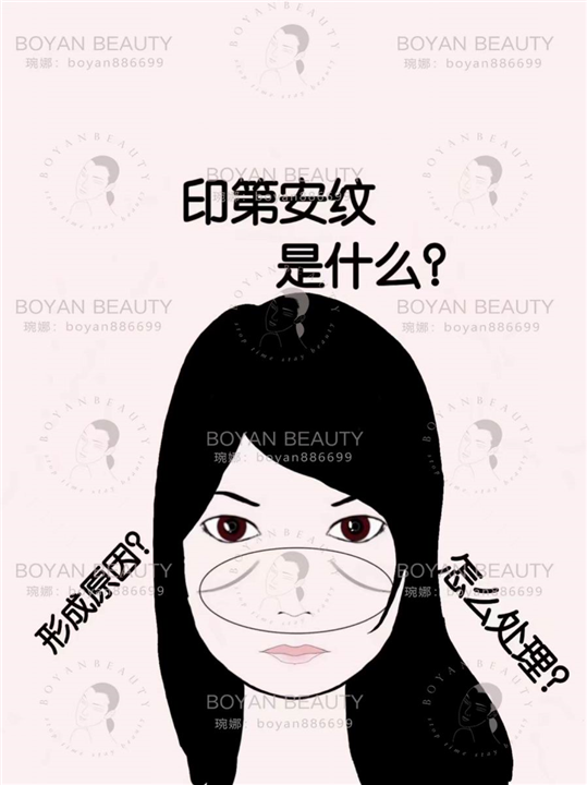 印第安纹是什么