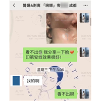 印第安纹剥离