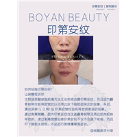 剥离微雕