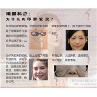 剥离微整价格