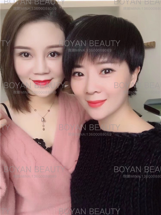 剥离卧蚕 