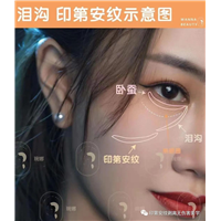 印第安纹怎么去除效果好？琬娜老师科普