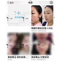 剥离微整