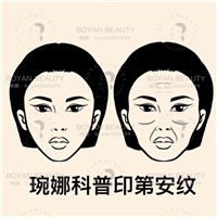 印第安纹剥离美学