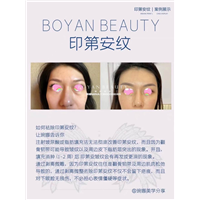 剥离微雕价格