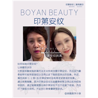 剥离微雕