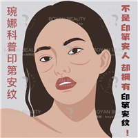 广州印第安纹剥离