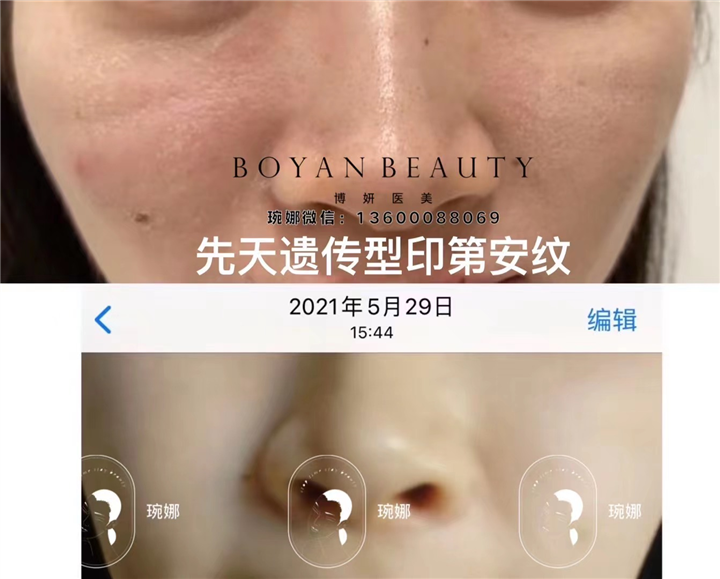 琬娜印第安纹美学科普