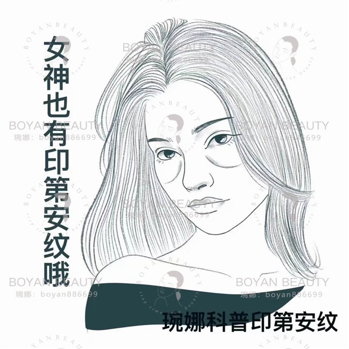剥离微整费用