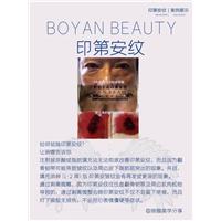 剥离微雕