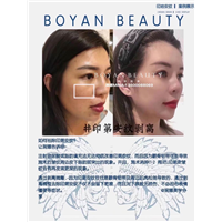 剥离微整价格
