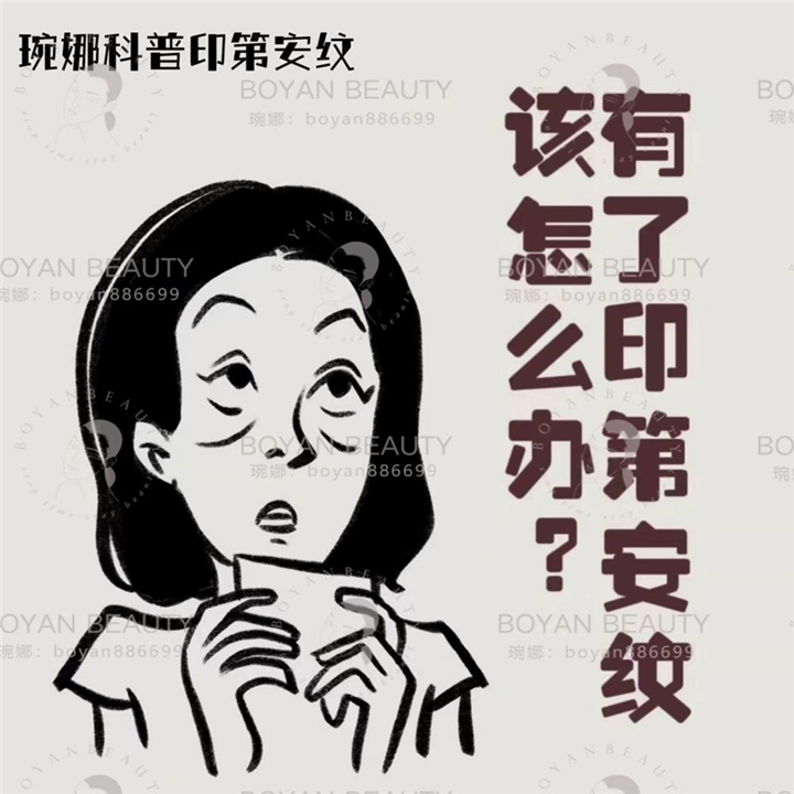 印第安纹剥离后多久能恢复