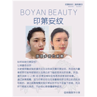 剥离微雕