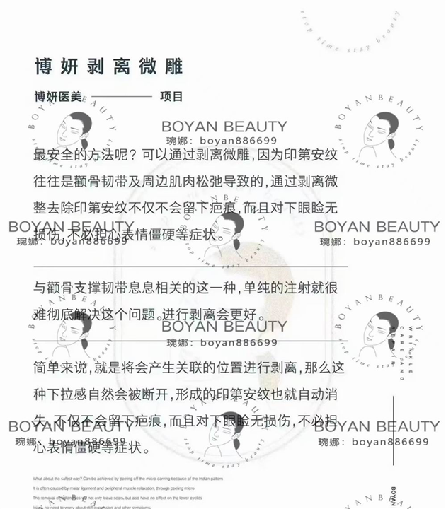 剥离微整