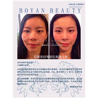 剥离微雕价格