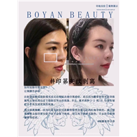 剥离微雕价格