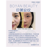 剥离微雕价格