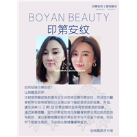 剥离微雕价格