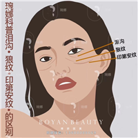 泪沟,狼纹,印第安纹