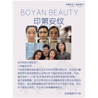 剥离微雕