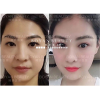 剥离微雕价格