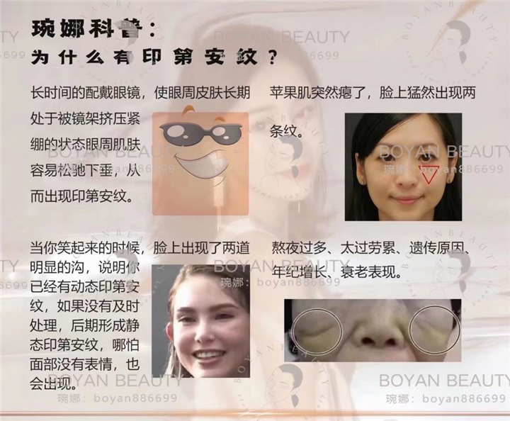 剥离微整价格