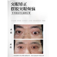 成都陈辉医生突眼案例