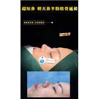 上海鼻整形周俊杰医生