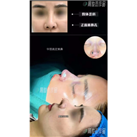 周俊杰医生