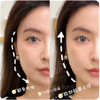 常州正骨医生