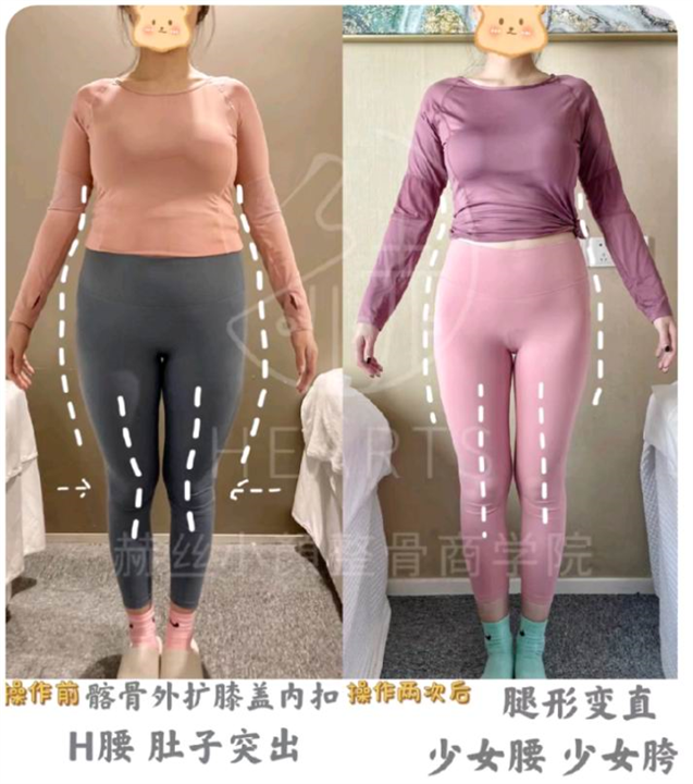 常州小颜整骨
