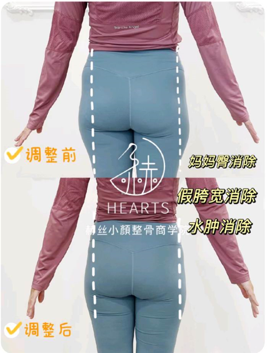 常州产后形体纠正