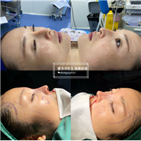上海鼻综合修复医生推荐