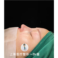 上海隆鼻整形哪家好 