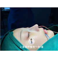 上海董洋洋鼻整形医生 