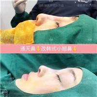 武汉面部年轻化整形