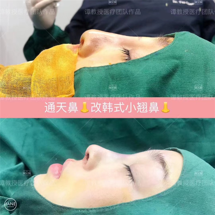 武汉面部年轻化整形